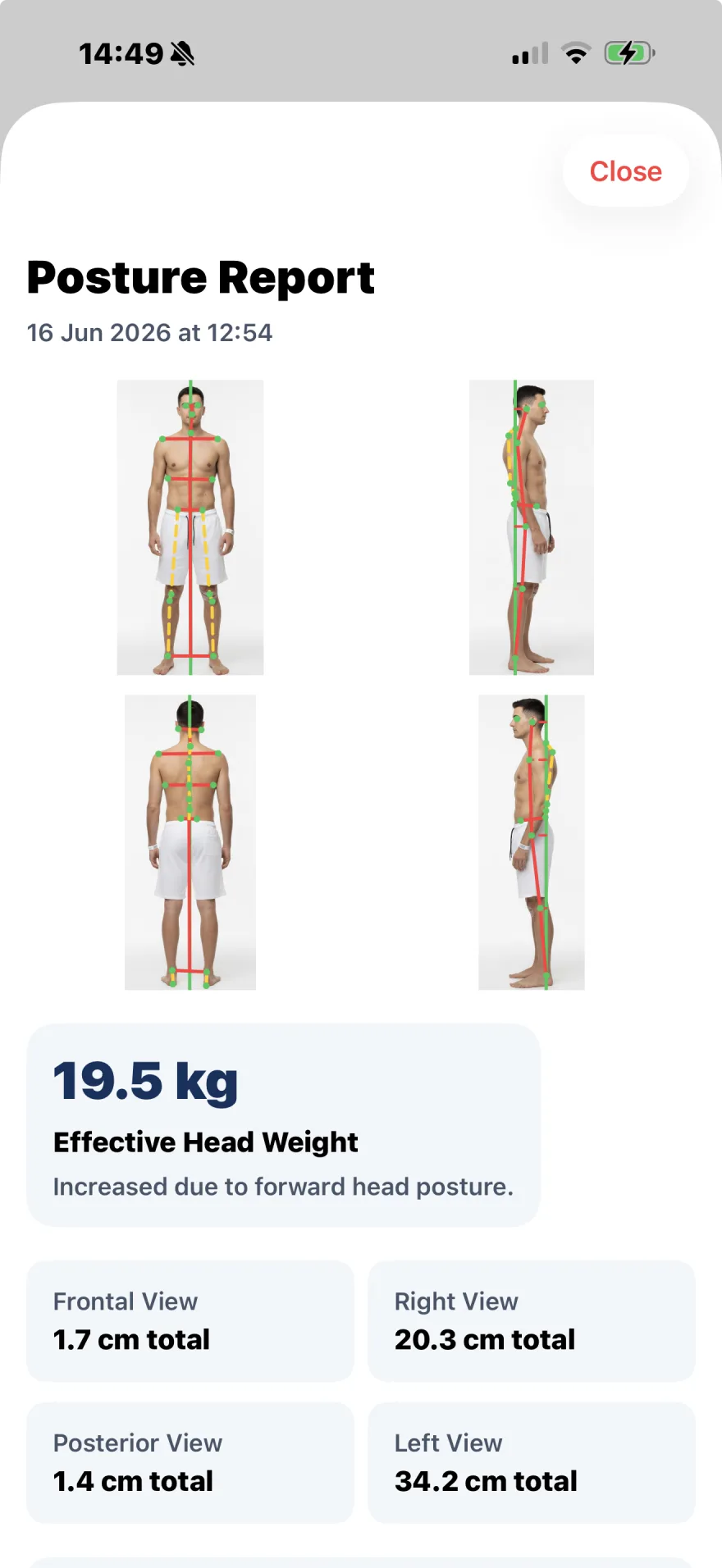 PostureSync posture report in the PhysioSync app, showing the four views and measurements